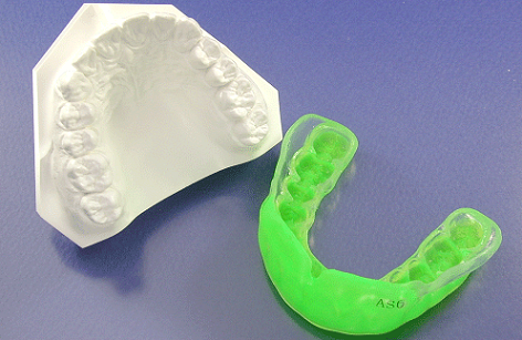 「矯正歯科」の型取り模型